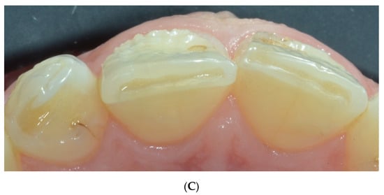 Nutrients 15 01785 g004b 550