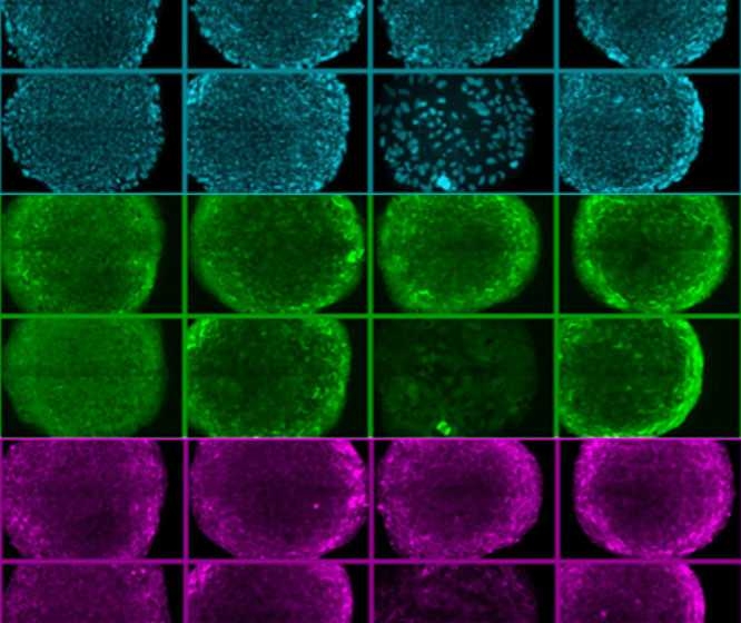 This image shows rows of human embryonic stem cells that MIT researchers grew on a new synthetic surface. The cells at top (blue) are stained to reveal their nuclei, while the cells in the middle and bottom are stained for proteins that are known to be present when cells are pluripotent.