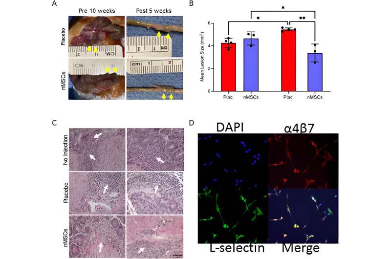 Neonatal stem cells from the heart could treat Crohn's disease