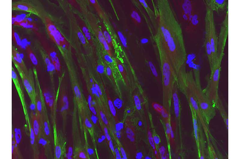 Gene editing system restores dystrophin function in stem cells from patients with Duchenne muscular 