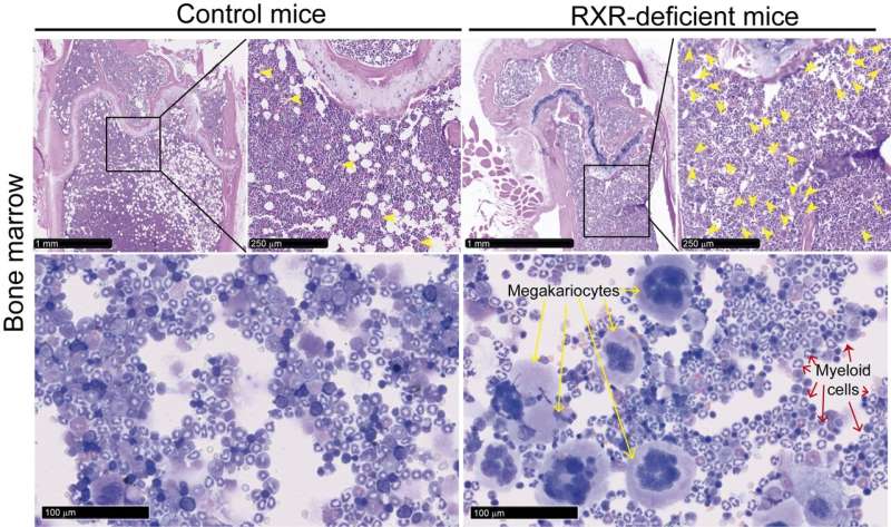 RXR, the cell protein that keeps blood stem cells young and fit