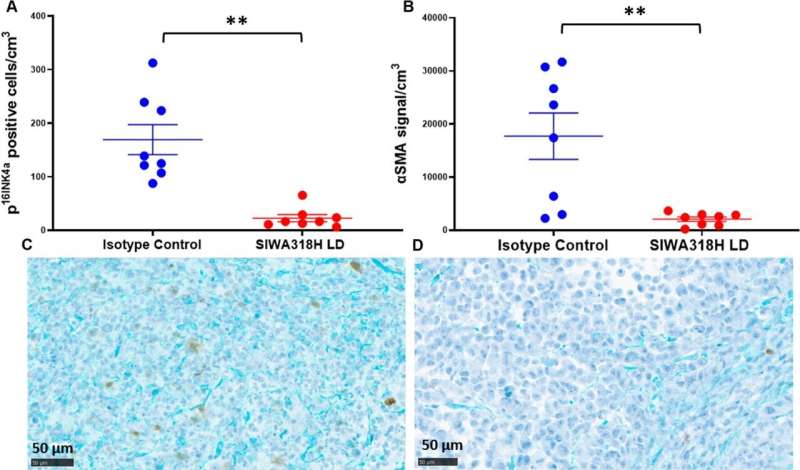 New antibody shows strong potential as treatment against pancreatic cancer 