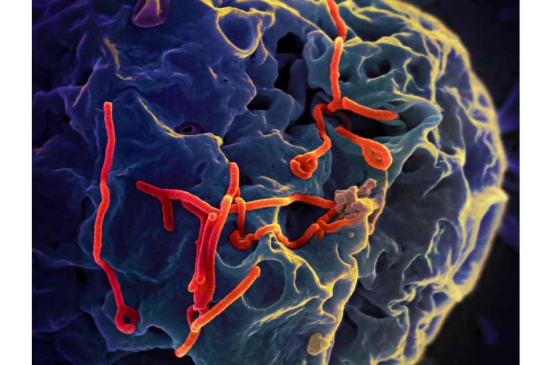 Researchers use stem cells to investigate liver damage from the Ebola virus 