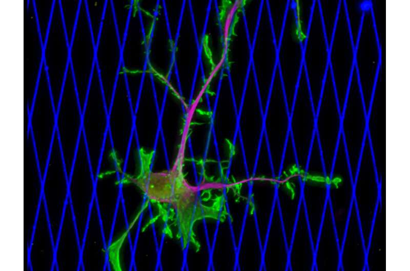 Mechanics of breast cancer metastasis discovered, offering target for treatment