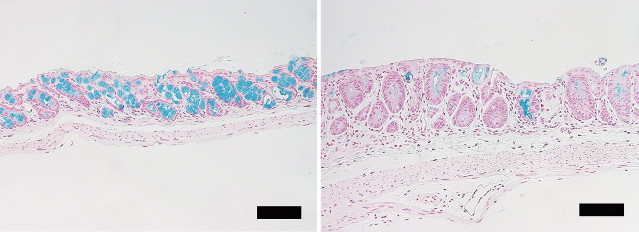 Loss of intestinal goblet cells causes fatal disease after stem cell transplantation