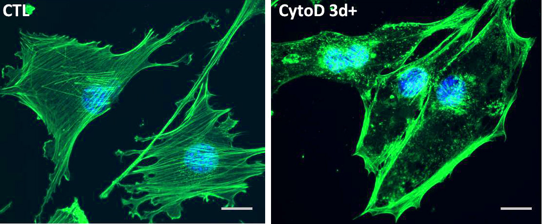 Researchers find new way to force stem cells to become bone cells