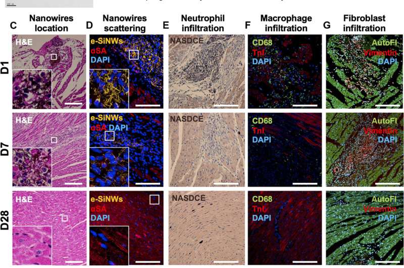 Repairing the heart with silicon nanowires and stem cell cardiomyocytes