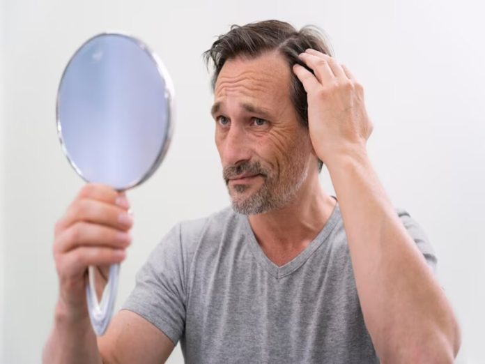 How to Prepare for a Hair Transplant