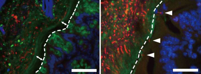 Loss of intestinal goblet cells causes fatal disease after stem cell transplantation