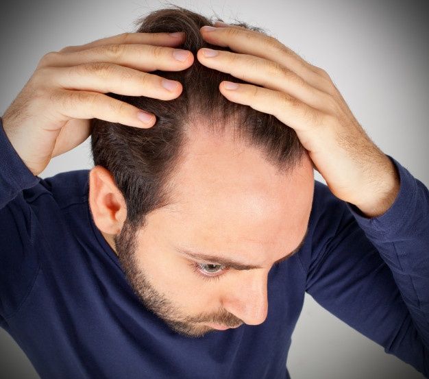 Causes of alopecia