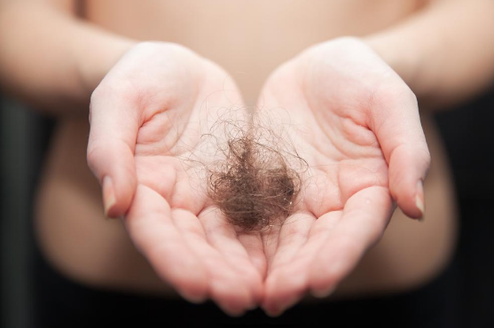 The Most Common Causes of Hair Loss