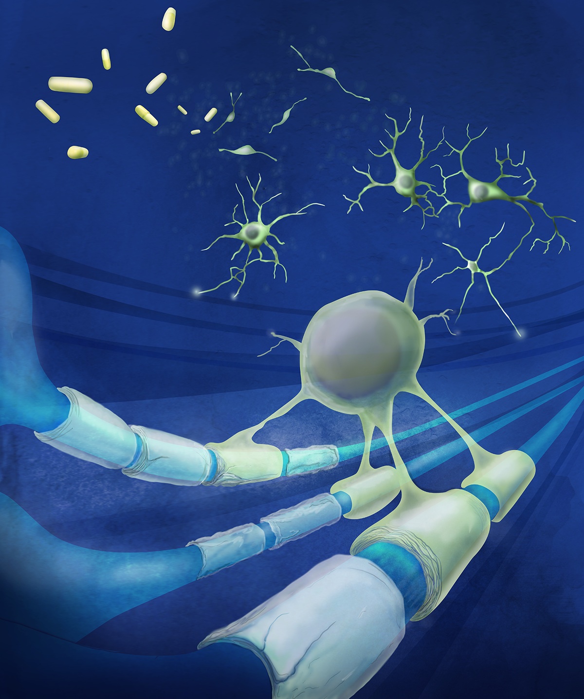 Drugs stimulate body's own stem cells to replace brain cells lost in multiple sclerosis