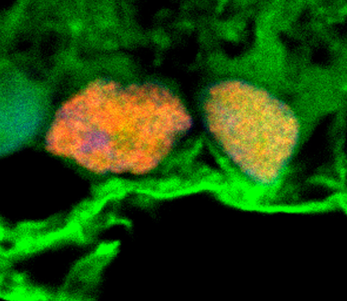 Scientists find that stem cell exosomes promote survival of retinal ganglion cells in rats 