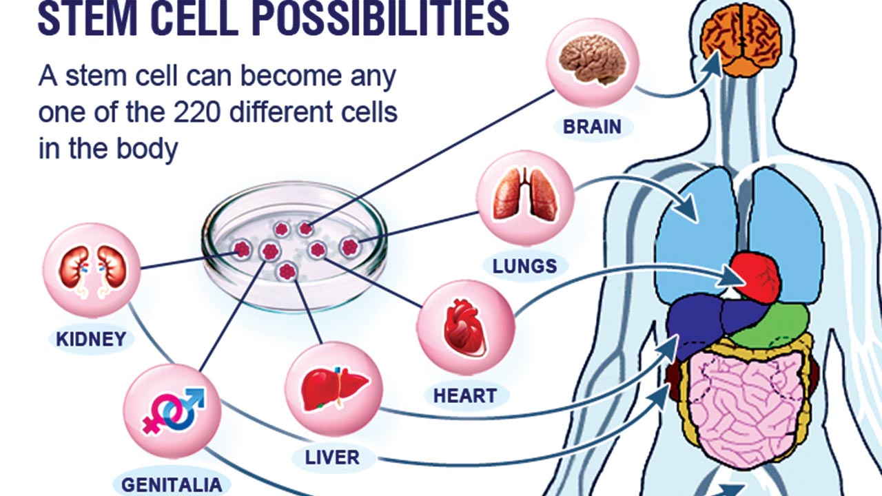 Stem-cell-therapy