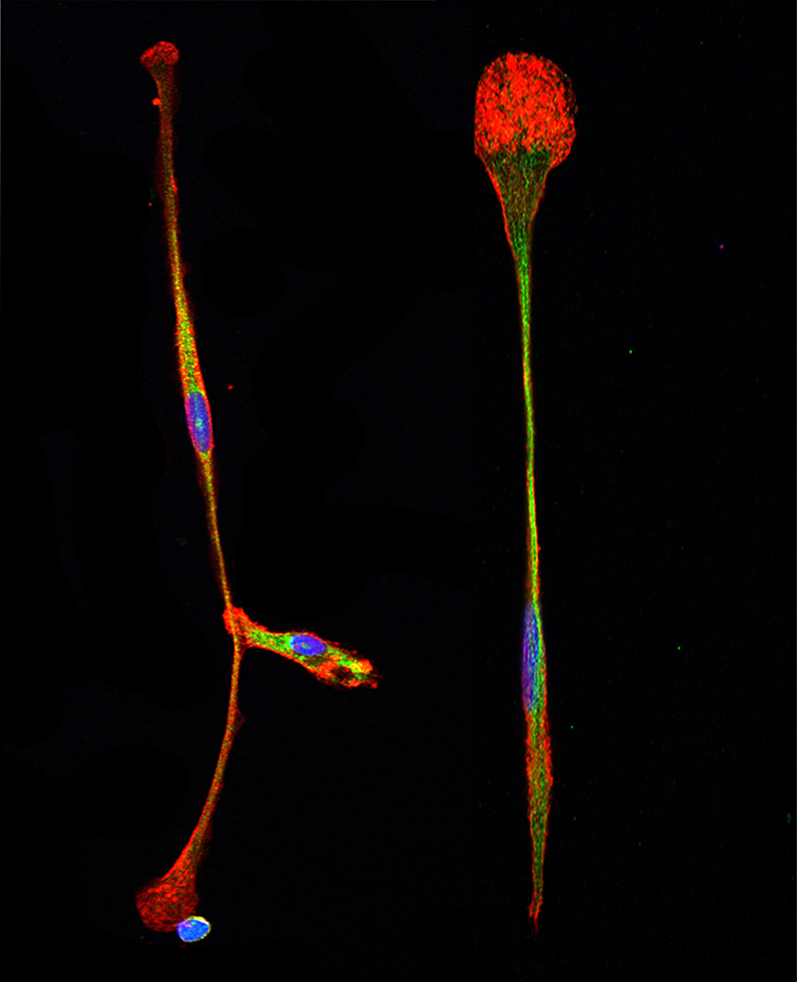 Scientists find antibody that transforms bone marrow stem cells directly into brain cells