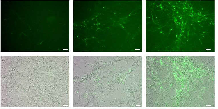 From stem cell to nerve cell in a few weeks