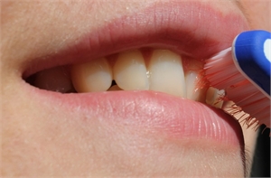 Close-up photograph of toothbrush bristles cleaning teeth of a patient