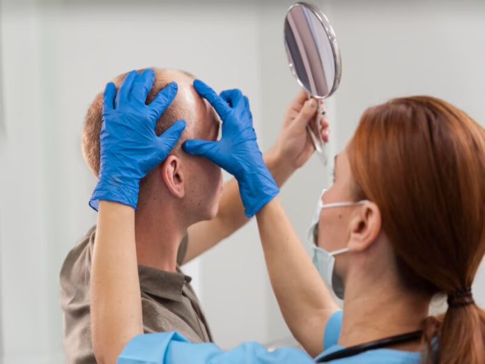 Une greffe de cheveux peut-elle être réparée ?