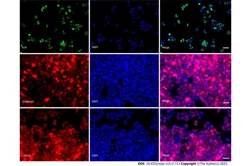 Transplanting human induced pluripotent stem cell derived keratinocytes speeds deep second-degree burn wound healing