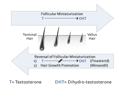 testosterone