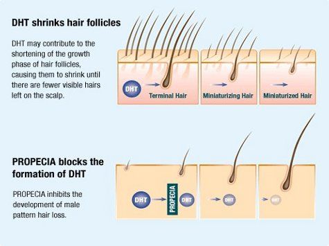 Finasteride_01