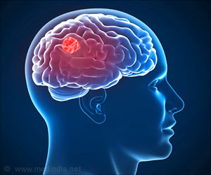 Quiz on Brain Tumor