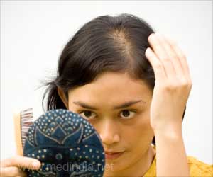 Hair Loss in Women