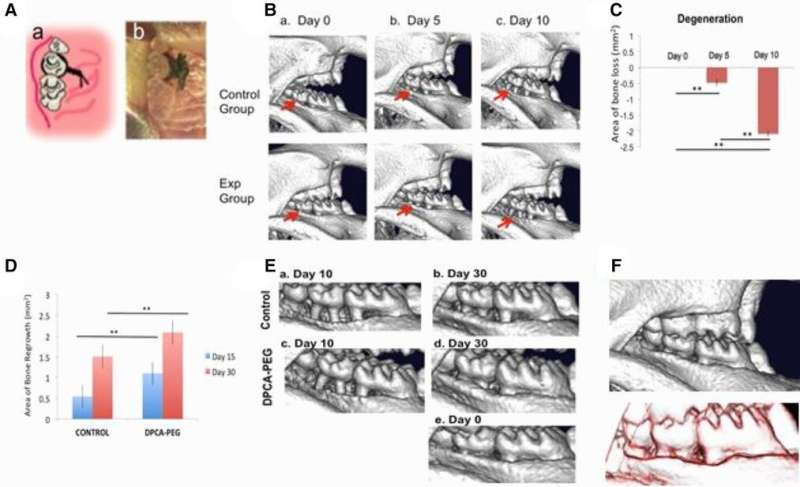 Regenerative drug restores bone in new research study