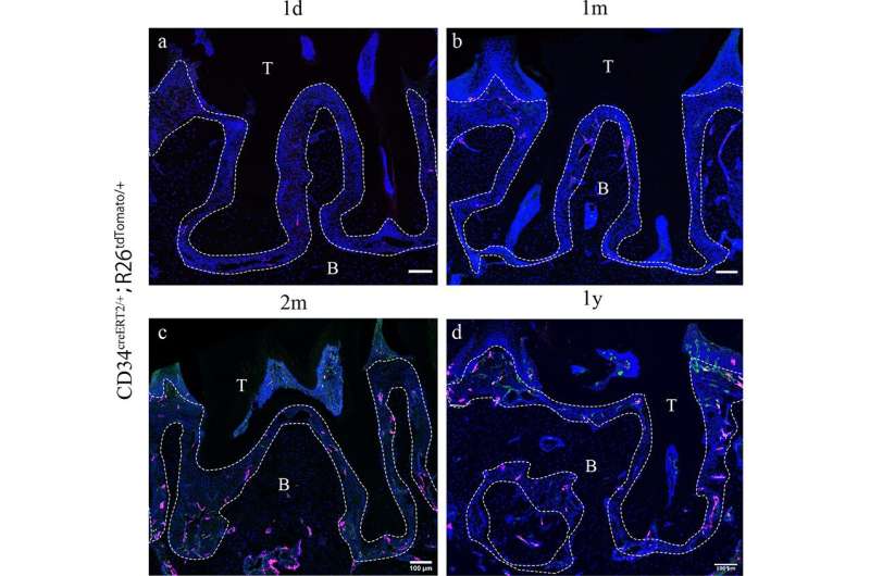 New research identifies potential treatment to manage effects of periodontitis