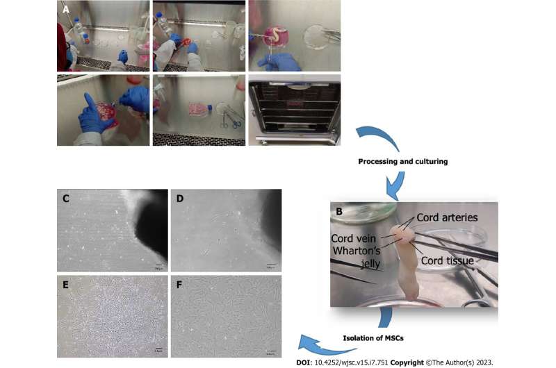 Zinc enhances cell adhesion, migration, self-renewal potential of human umbilical cord-derived mesenchymal stem cells