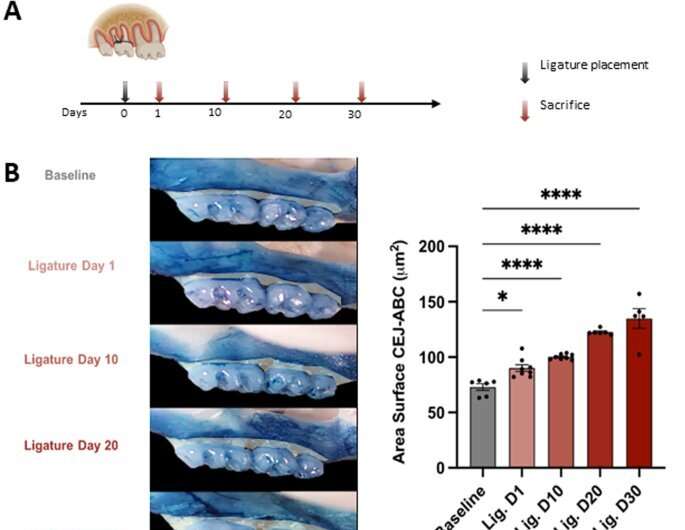 Gum disease linked to buildup of Alzheimer's plaque formation