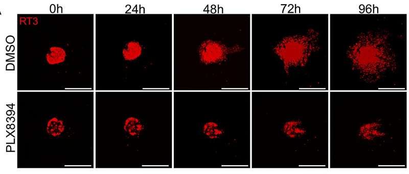 New drug developed for melanoma and lung cancer shows potential in treatment of cutaneous squamous cell carcinoma 