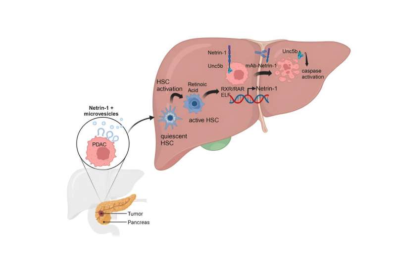 Pancreatic cancer discovery opens the door for new clinical trial