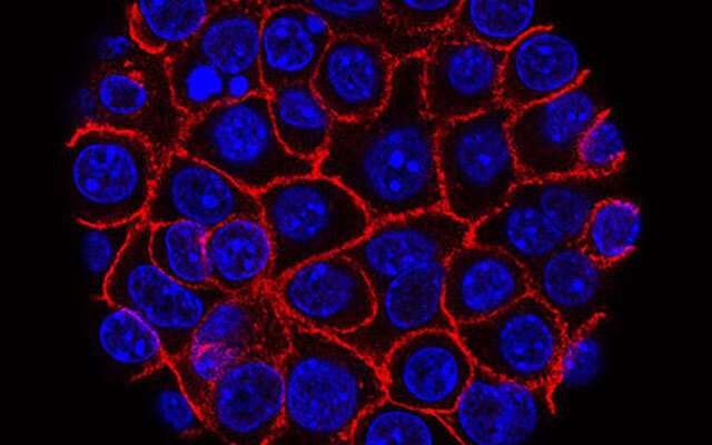 Pancreatic cancer cells (blue) growing as a sphere encased in membranes (red). Credit: National Cancer Institute