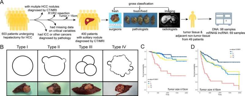 Morphology-based gross classification system for HCC stratification