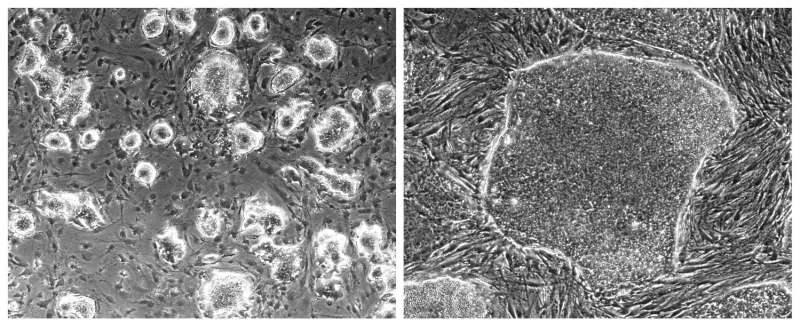 Gauging stem cells for regenerative medicine