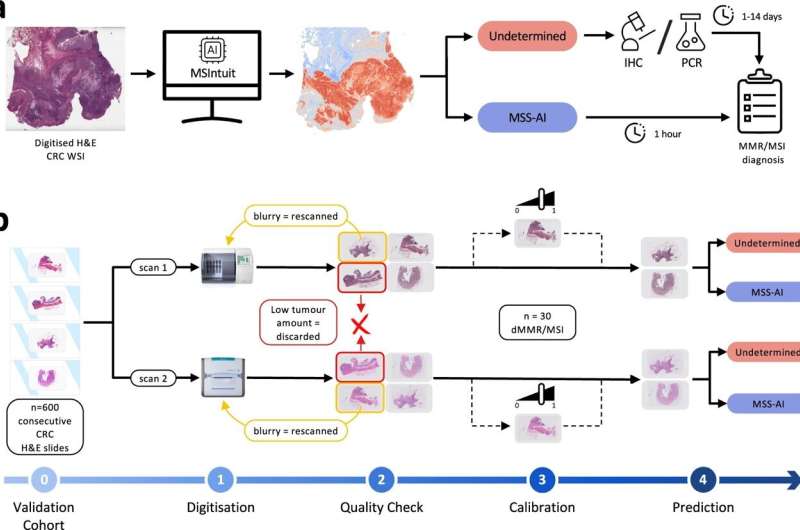 Clinical workflow and blind validation methodology. a Clinical workflow of MSI screening with MSIntuit. Using a routine H&amp;E slide of CRC, MSIntuit outputs if the patient is likely to be MSI (Undetermined) and should receive a confirmatory test (MMR-IHC and/or MSI-PCR), or not (MSS-AI). By ruling out a significant fraction of non-MSI patients, the workload of pathologists is reduced and the MSI screening is accelerated. b H&amp;E slides of 600 consecutive resected CRC specimens were collected and digitized on two scanners, Phillips UFS and Ventana DP200, resulting in two sets of slides: MPATH-UFS and MPATH-DP200 (step 1). For each cohort, the same pipeline was then applied: an automated quality check discarded slides that did not match criteria (large blurry regions, too few tumor). Slides with large blurry regions were rescanned (step 2). Next, 30 dMMR/MSI WSIs were selected randomly and used to define an appropriate threshold (step 3). Finally, MSIntuit prediction was performed on the remaining slides using the threshold defined in the aforementioned step to classify patients into two categories: MSS-AI and Undetermined (step 4). Credit: Nature Communications (2023). DOI: 10.1038/s41467-023-42453-6