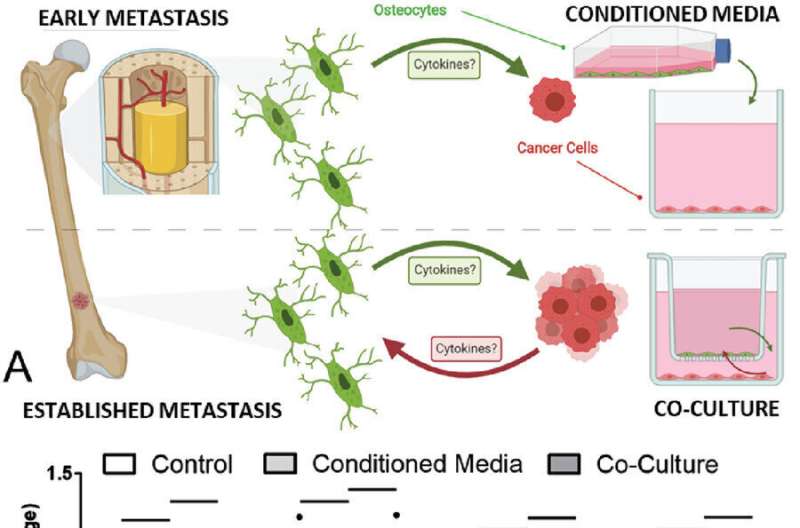 Immune mechanism found in osteocyte cells could lead to drug target to prevent the spread of cancer to bones