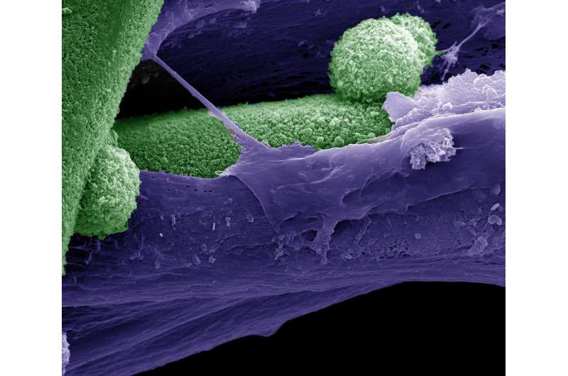 Nano crystals impact stem cell fate during bone formation