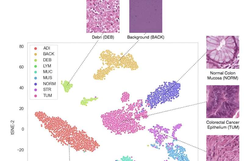 Each dot represents an image piece from a cancer microscope slide. The AI system has automatically arranged them by similarity. Credit: Scientific Reports (2023). DOI: 10.1038/s41598-023-42357-x