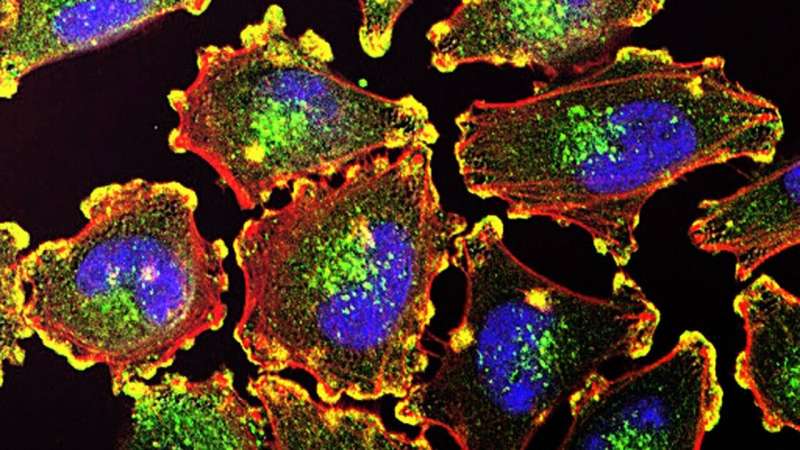 UMD researchers have successfully combined three photoimmunotherapy technologies to help prevent the spread and return of metastatic cancer, while minimizing side effects of treatment. Credit: National Institutes of Health