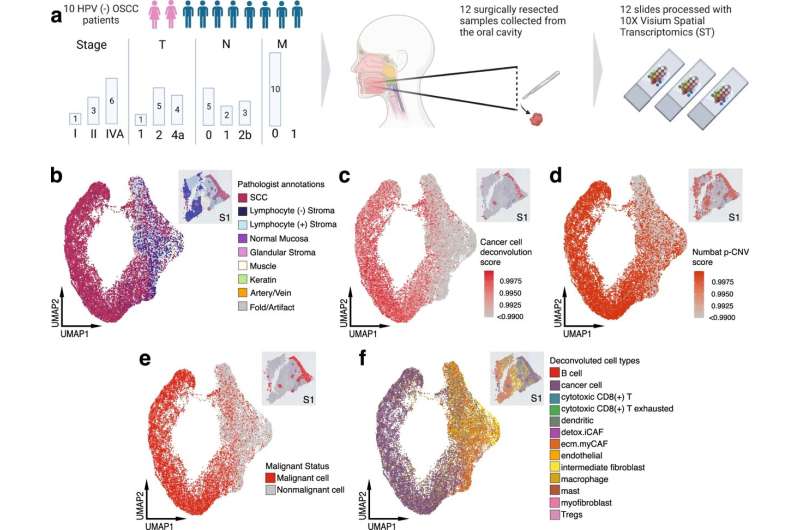 Overview of experimental design for ST analysis and cellular deconvolution of OSCC patient samples. a Schematic representing patient clinical data and sample acquisition and processing strategy. UMAP projection of 24,876 spots aggregated from all 12 spatially-profiled samples colored based-on. Created with BioRender. b Pathologist annotations, c single-cell HNSCC deconvolution based on scRNA-seq data from Puram et al., d CNV probability per spot, e malignant spot status, and f. spot annotations based on deconvolution and CNV probabilities. HPV human papillomavirus, OSCC oral squamous cell carcinoma, SCC squamous cell carcinoma, Tregs T-regulatory cell. Credit: Nature Communications (2023). DOI: 10.1038/s41467-023-40271-4