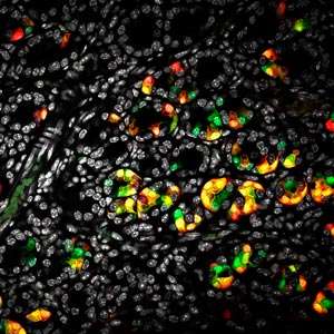 Stem cell behavior revealed by a combination of modeling and microscopy