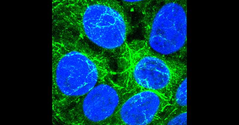 When missing a critical signaling enzyme, liver cells (blue) use vesicles (green) to communicate and share resources in order to multiply. Cancer cells may use the same process to resist therapy. Credit: UC San Diego Health Sciences