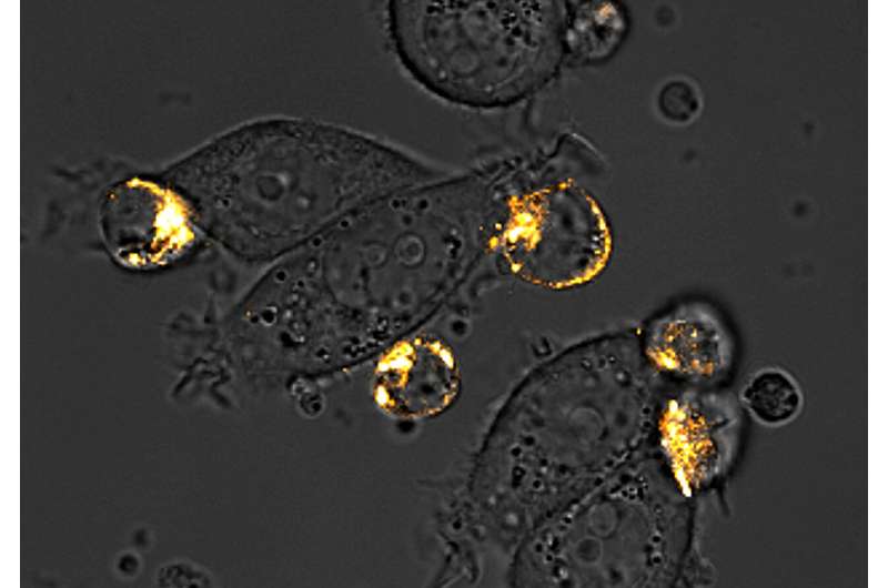 Microscopy image of CAR-T cells attacking "painted" breast cancer cells. Credit: Rosa Vincent and Thomas Savage