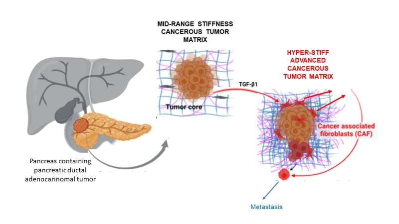 Advanced pancreatic cancer model for developing personalized therapies