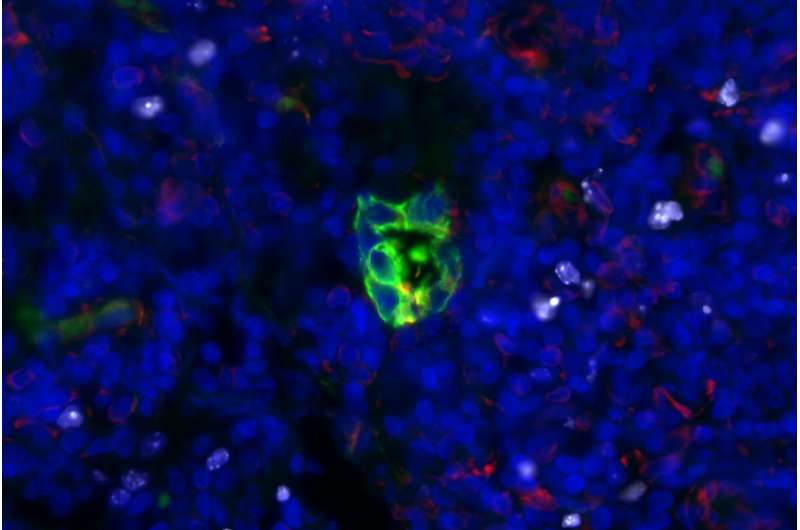 Memorial Sloan Kettering scientists identify potential new strategy against metastasis