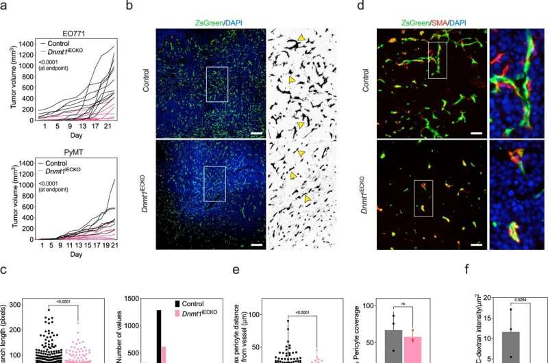 Cancer discoveries could enhance immunotherapy, breast cancer care