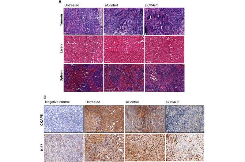 Cancer therapy - gene silencing of cytoskeleton-associated protein 5 in genetically unstable cancer cells