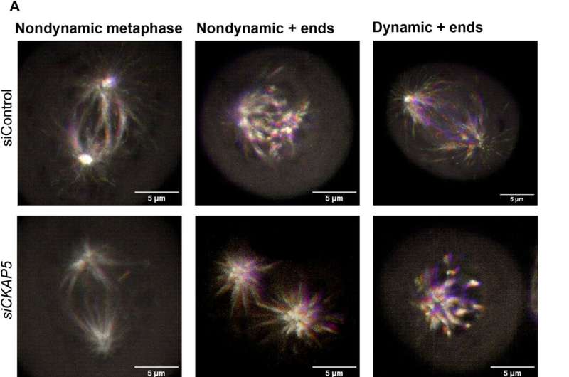 Cancer therapy - gene silencing of cytoskeleton-associated protein 5 in genetically unstable cancer cells